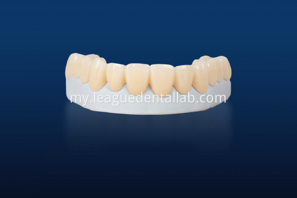 Full zirconia